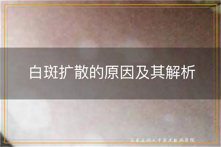 白斑扩散的原因及其解析
