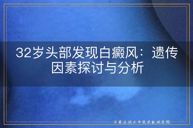 32岁头部发现白癜风：遗传因素探讨与分析