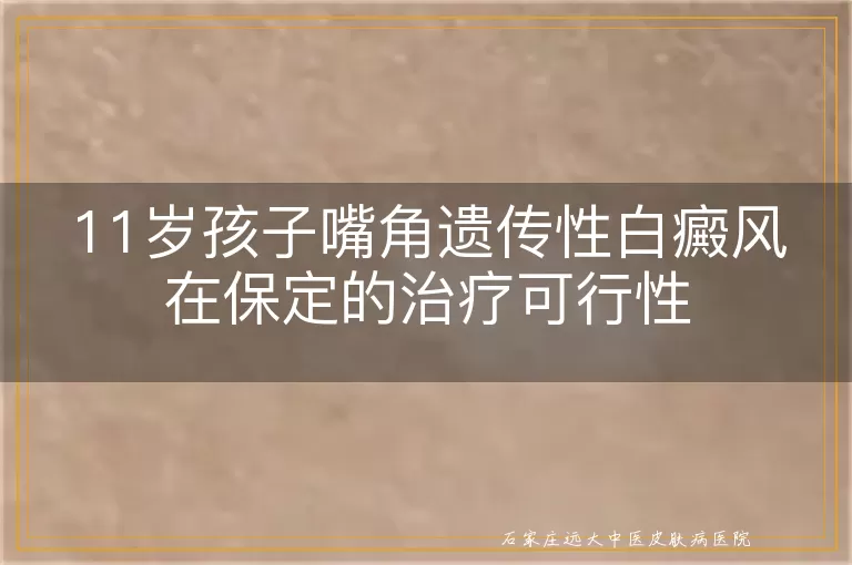 11岁孩子嘴角遗传性白癜风在保定的治疗可行性
