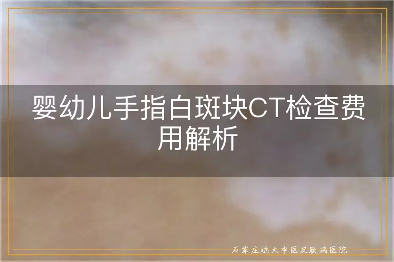 婴幼儿手指白斑块CT检查费用解析