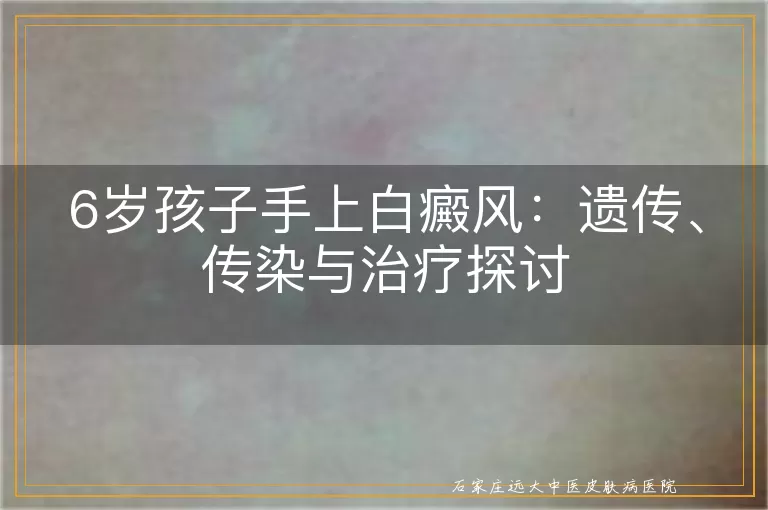 6岁孩子手上白癜风：遗传、传染与治疗探讨