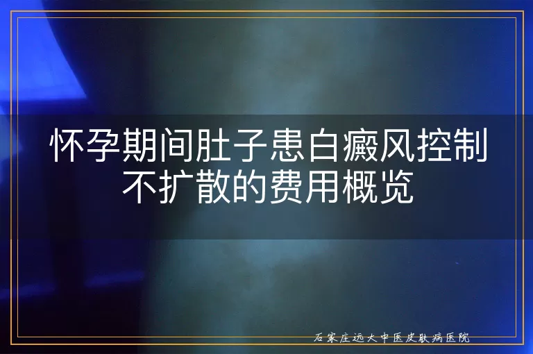 怀孕期间肚子患白癜风控制不扩散的费用概览