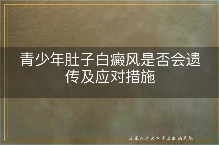 青少年肚子白癜风是否会遗传及应对措施