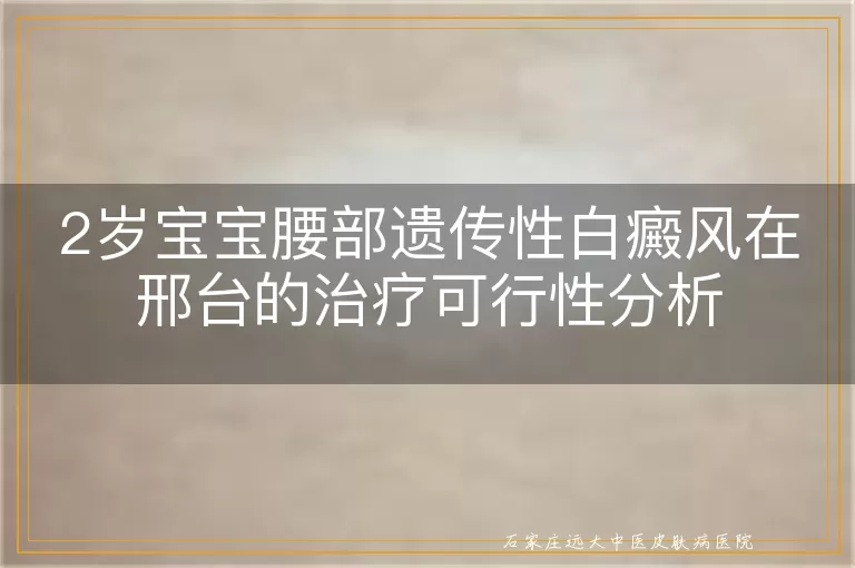 2岁宝宝腰部遗传性白癜风在邢台的治疗可行性分析