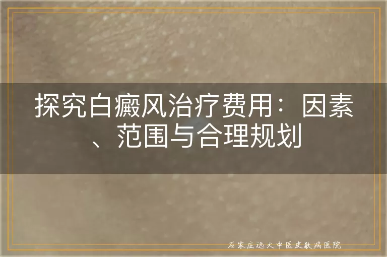 探究白癜风治疗费用：因素、范围与合理规划