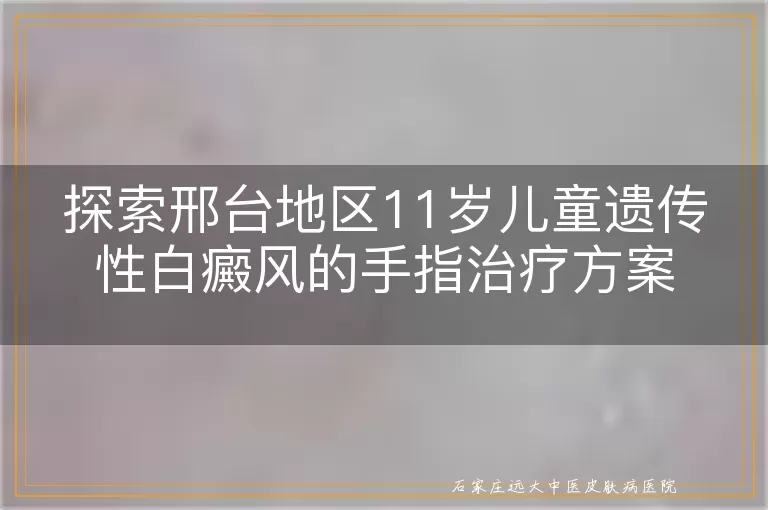 探索邢台地区11岁儿童遗传性白癜风的手指治疗方案