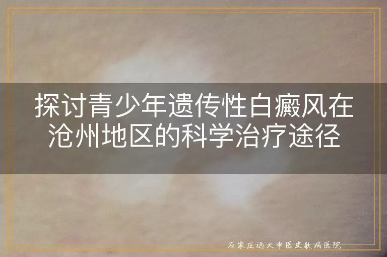 探讨青少年遗传性白癜风在沧州地区的科学治疗途径