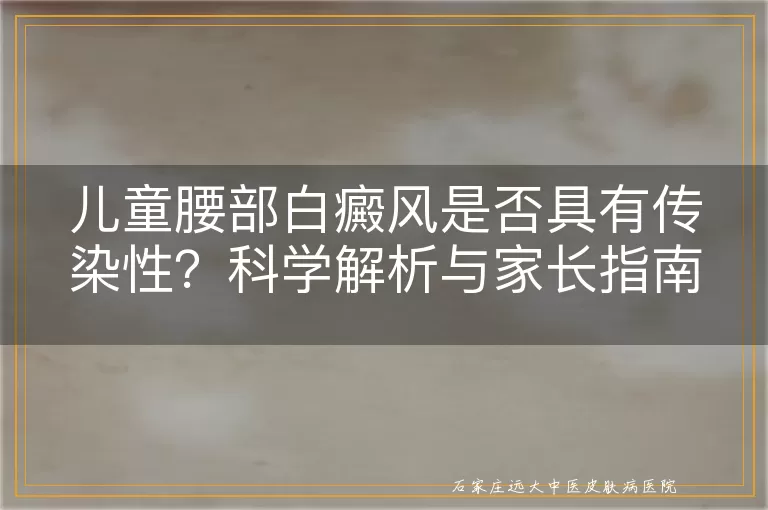 儿童腰部白癜风是否具有传染性？科学解析与家长指南