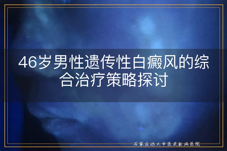 46岁男性遗传性白癜风的综合治疗策略探讨