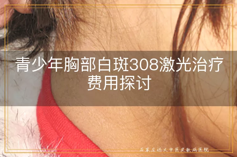 青少年胸部白斑308激光治疗费用探讨
