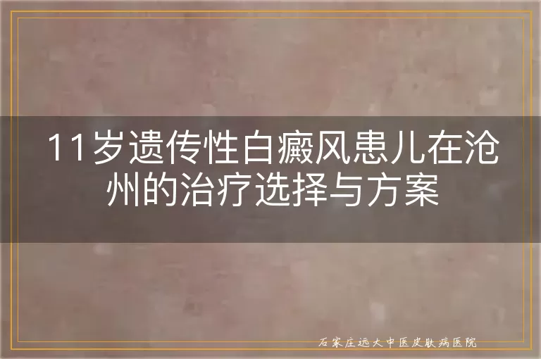 11岁遗传性白癜风患儿在沧州的治疗选择与方案