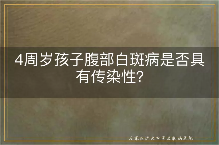 4周岁孩子腹部白斑病是否具有传染性？