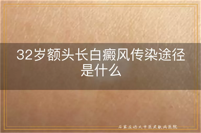 32岁额头长白癜风传染途径是什么