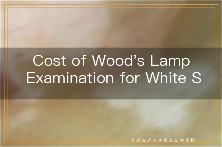 Cost of Wood's Lamp Examination for White Spots on a 38-Year-Old Male's Chest