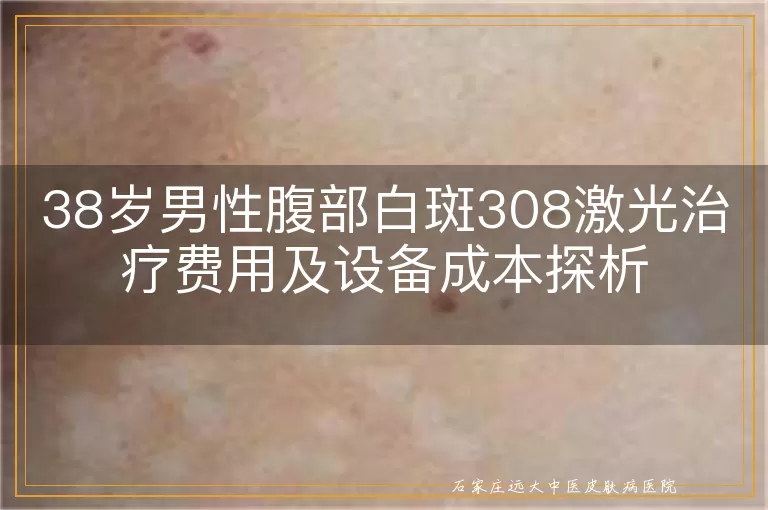 38岁男性腹部白斑308激光治疗费用及设备成本探析