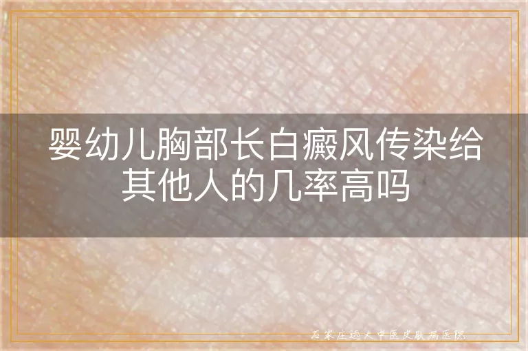 婴幼儿胸部长白癜风传染给其他人的几率高吗