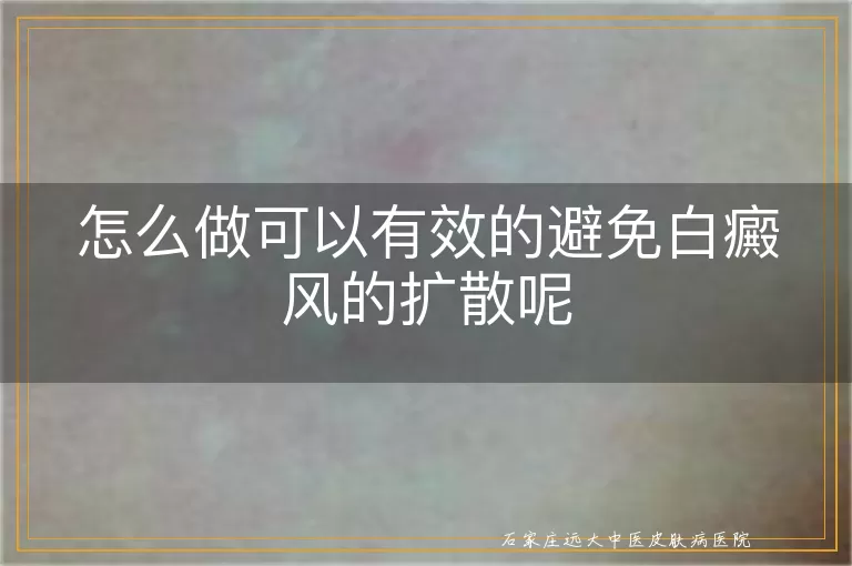 怎么做可以有效的避免白癜风的扩散呢
