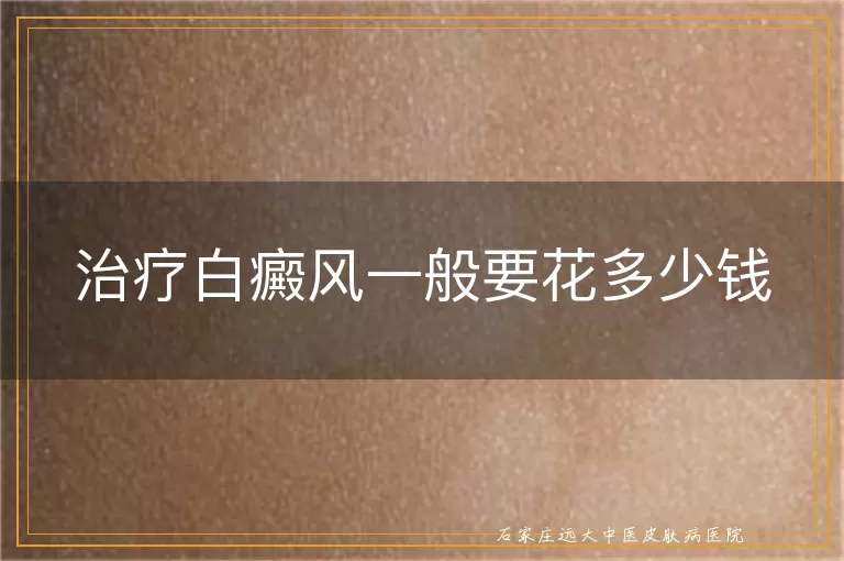 治疗白癜风一般要花多少钱