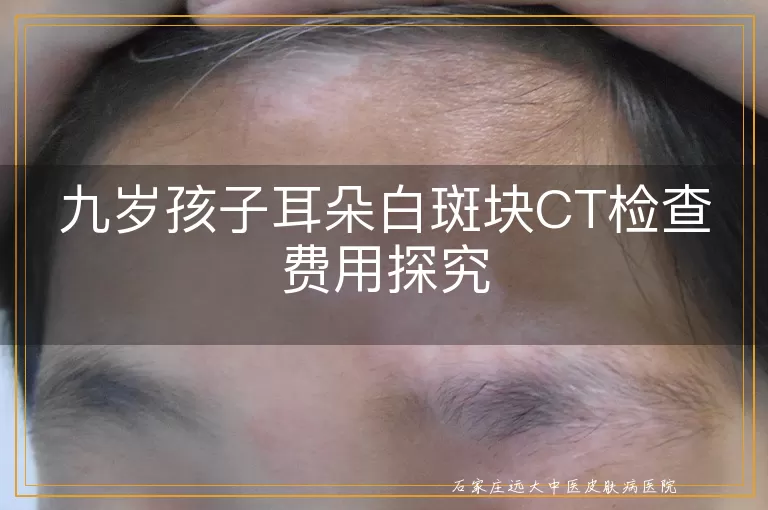 九岁孩子耳朵白斑块CT检查费用探究