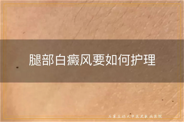腿部白癜风要如何护理