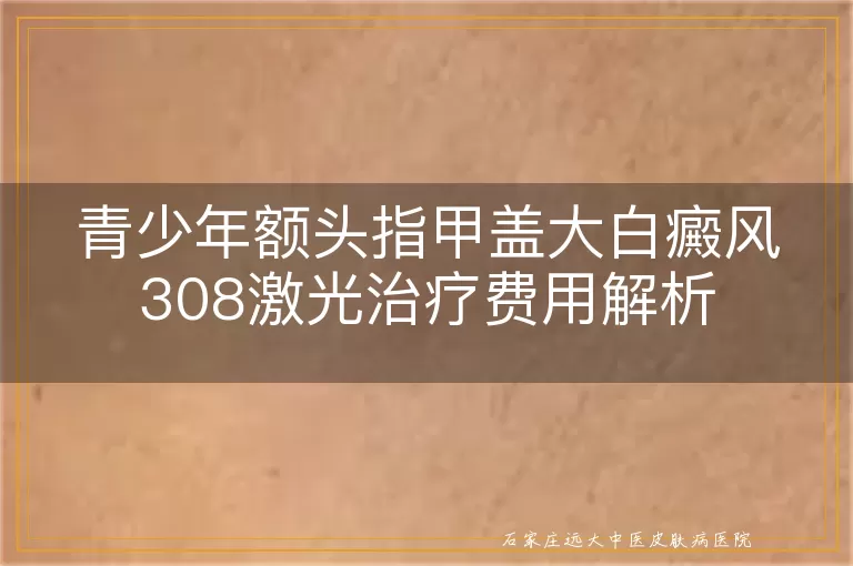 青少年额头指甲盖大白癜风308激光治疗费用解析