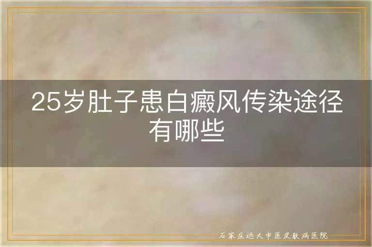 25岁肚子患白癜风传染途径有哪些