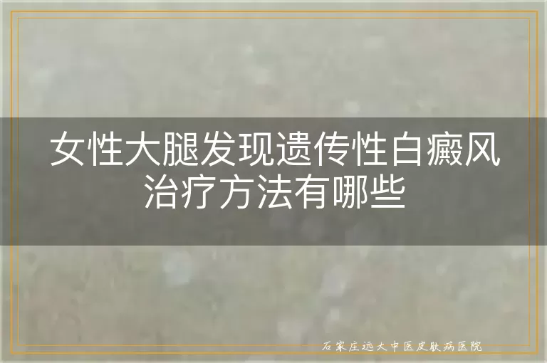 女性大腿发现遗传性白癜风治疗方法有哪些