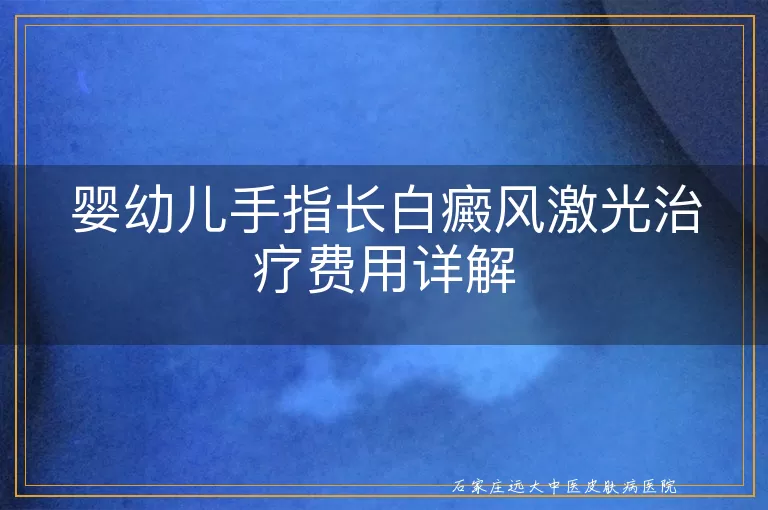 婴幼儿手指长白癜风激光治疗费用详解
