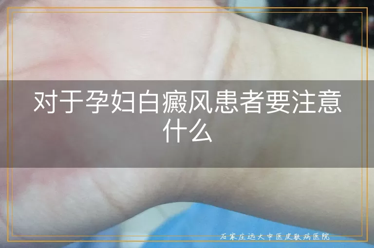 对于孕妇白癜风患者要注意什么