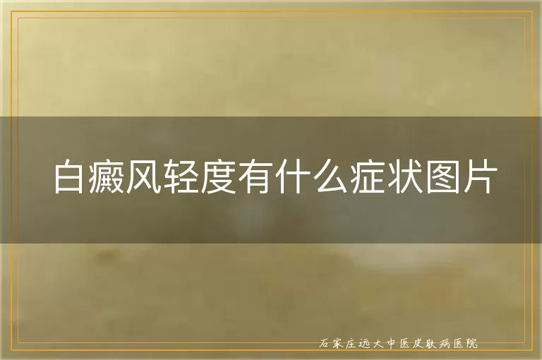 白癜风轻度有什么症状图片