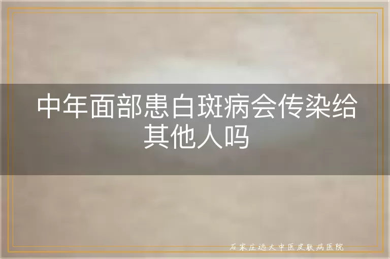 中年面部患白斑病会传染给其他人吗