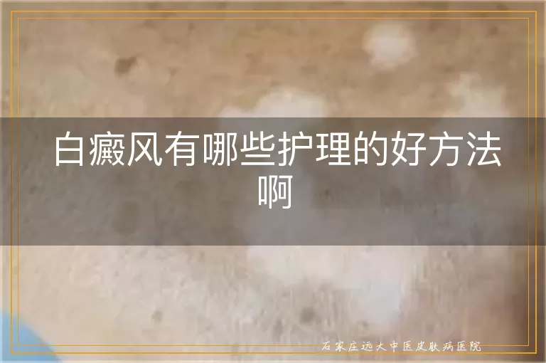 白癜风有哪些护理的好方法啊