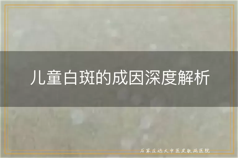儿童白斑的成因深度解析