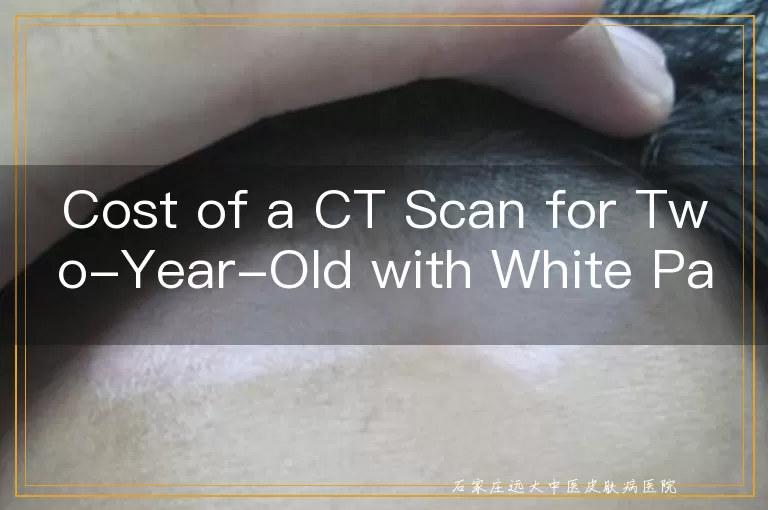 Cost of a CT Scan for Two-Year-Old with White Patches on the Face