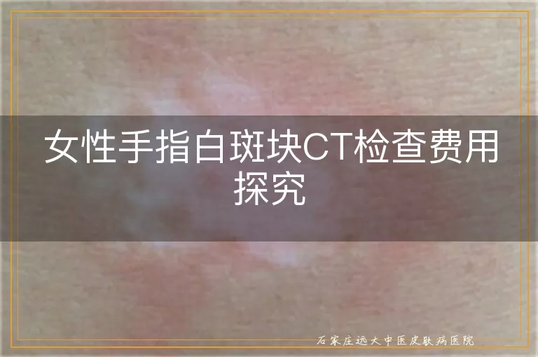 女性手指白斑块CT检查费用探究