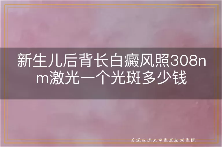 新生儿后背长白癜风照308nm激光一个光斑多少钱