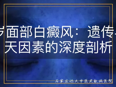 32岁面部白癜风：遗传与后天因素的深度剖析
