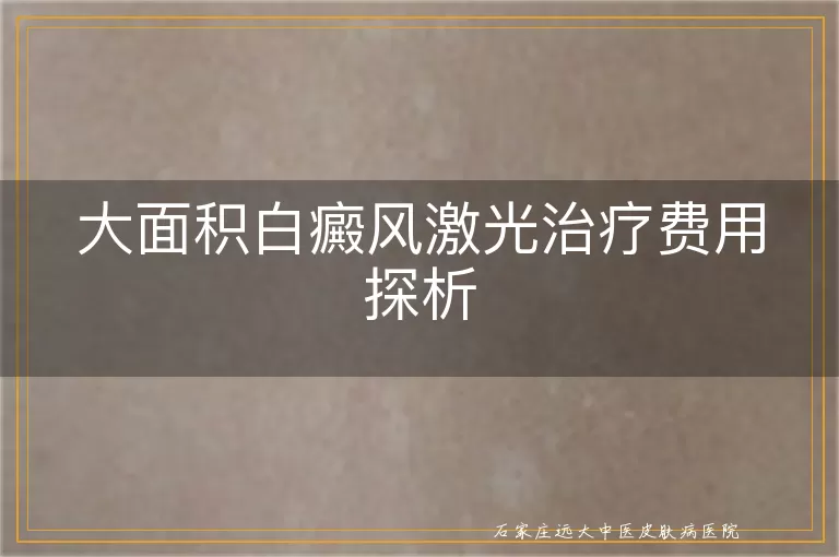 大面积白癜风激光治疗费用探析