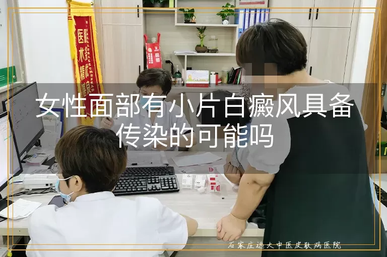 女性面部有小片白癜风具备传染的可能吗