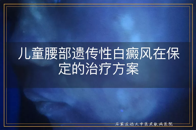 儿童腰部遗传性白癜风在保定的治疗方案