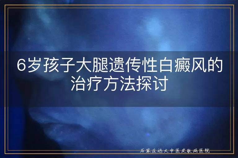 6岁孩子大腿遗传性白癜风的治疗方法探讨