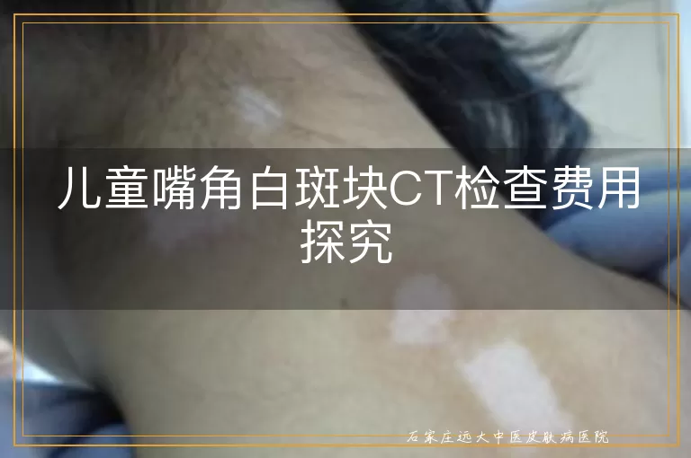 儿童嘴角白斑块CT检查费用探究