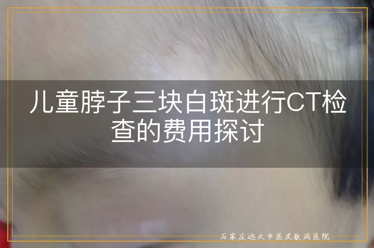 儿童脖子三块白斑进行CT检查的费用探讨
