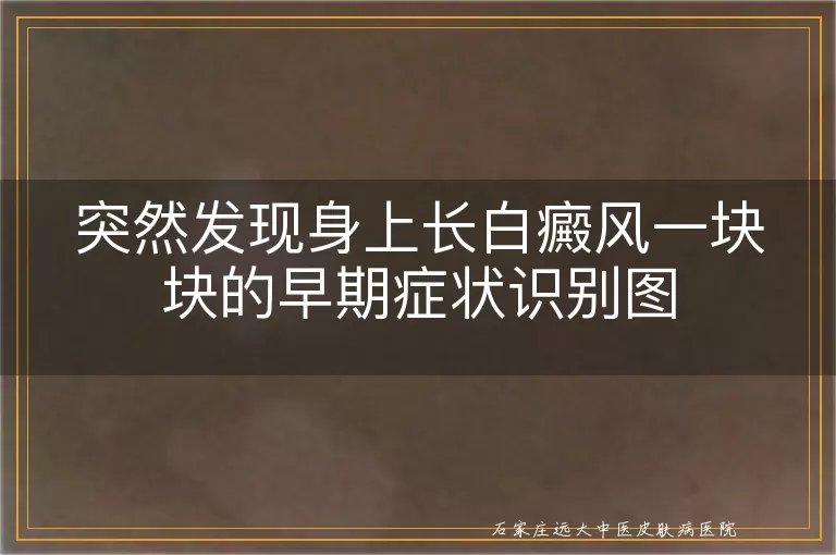 突然发现身上长白癜风一块块的早期症状识别图