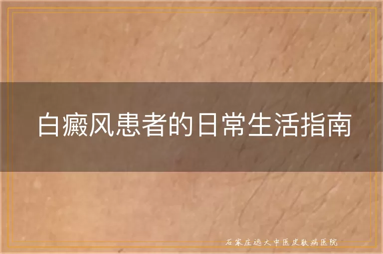 白癜风患者的日常生活指南