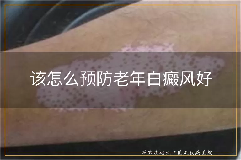 该怎么预防老年白癜风好