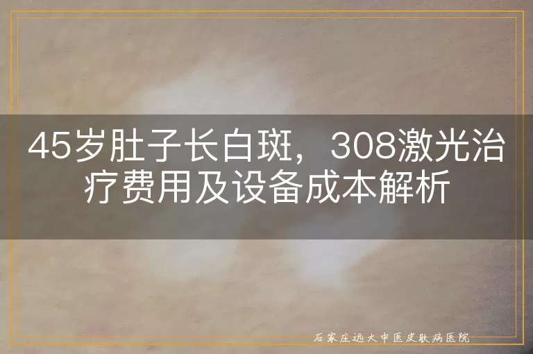 45岁肚子长白斑，308激光治疗费用及设备成本解析