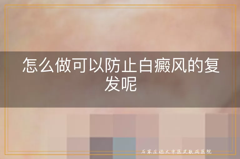怎么做可以防止白癜风的复发呢