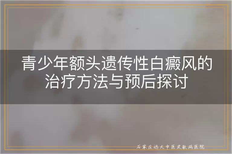 青少年额头遗传性白癜风的治疗方法与预后探讨