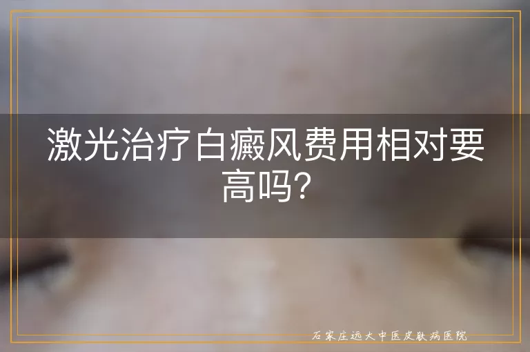 激光治疗白癜风费用相对要高吗？